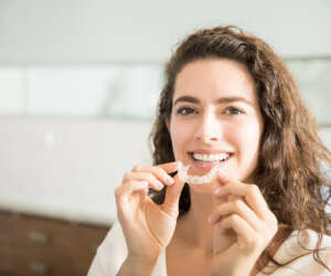 Teeth alignment Teeth alignment